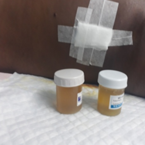 wellcare international hospital trichy wellcare international hospital trichy